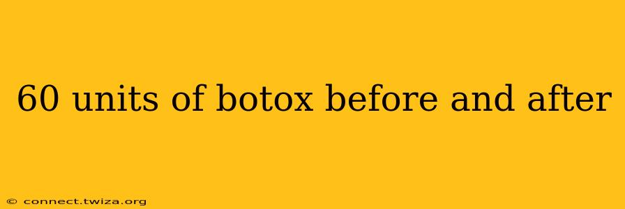 60 units of botox before and after