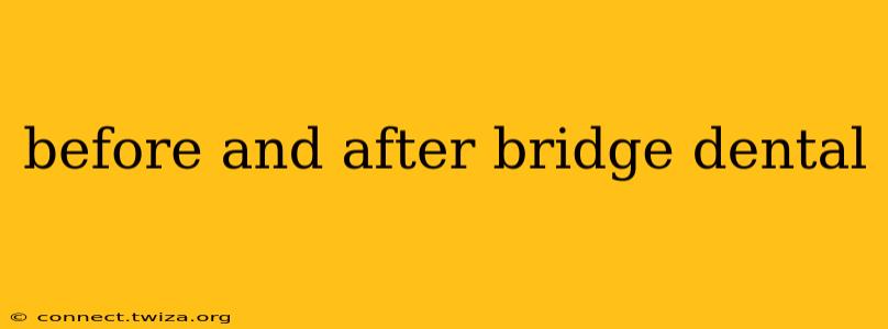 before and after bridge dental