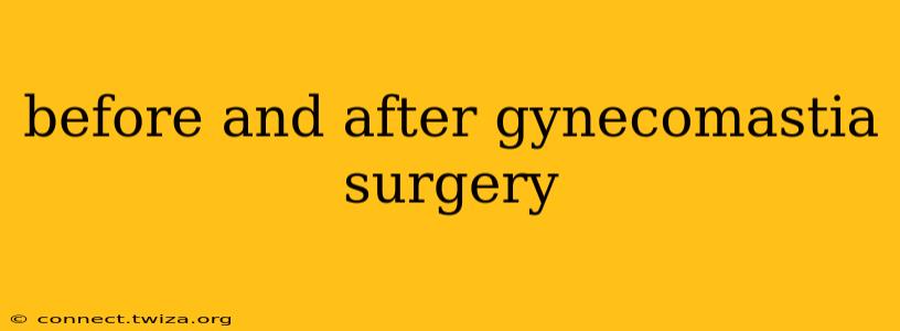 before and after gynecomastia surgery