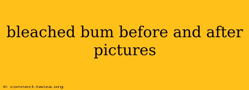 bleached bum before and after pictures
