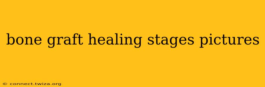 bone graft healing stages pictures