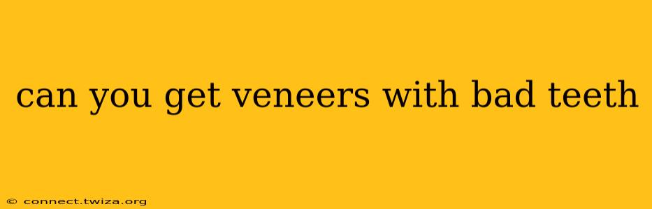 can you get veneers with bad teeth