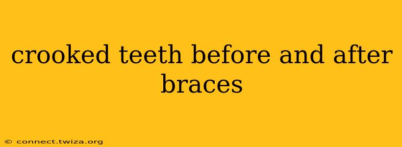 crooked teeth before and after braces
