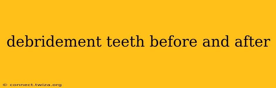 debridement teeth before and after