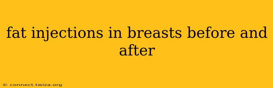 fat injections in breasts before and after