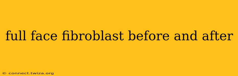 full face fibroblast before and after