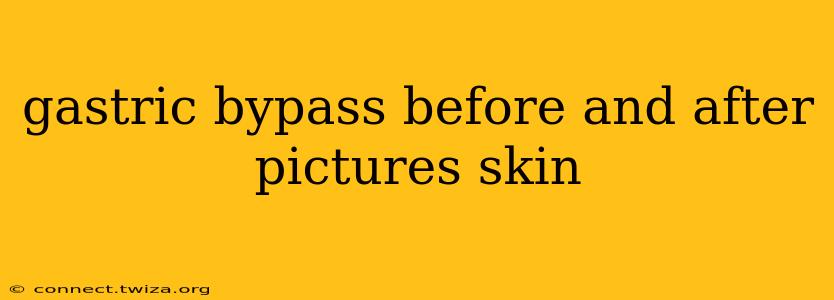 gastric bypass before and after pictures skin