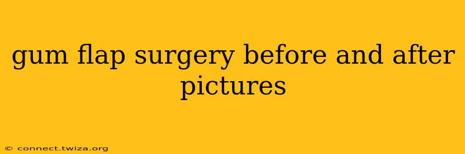 gum flap surgery before and after pictures