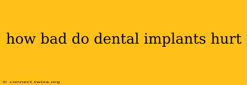 how bad do dental implants hurt