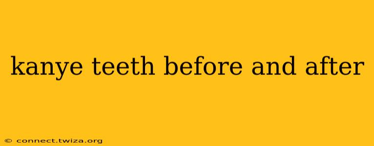 kanye teeth before and after