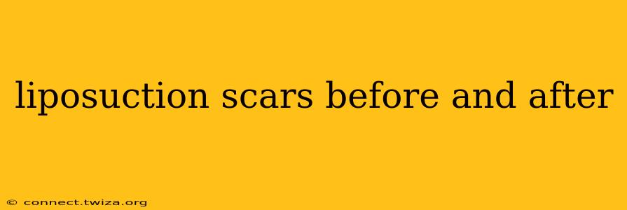 liposuction scars before and after