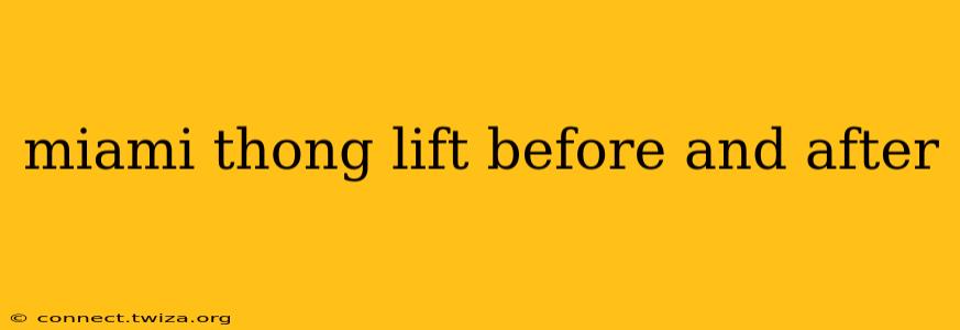miami thong lift before and after