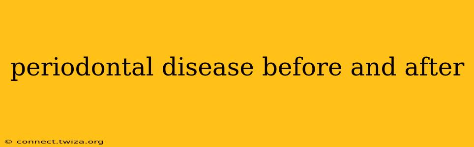 periodontal disease before and after