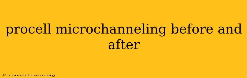 procell microchanneling before and after
