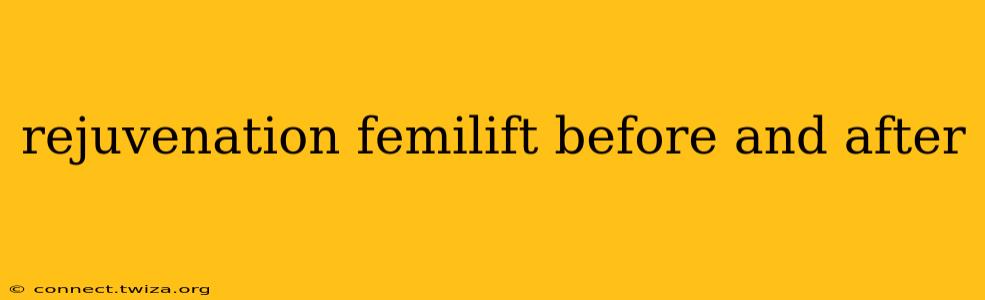 rejuvenation femilift before and after