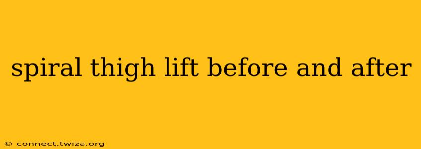 spiral thigh lift before and after