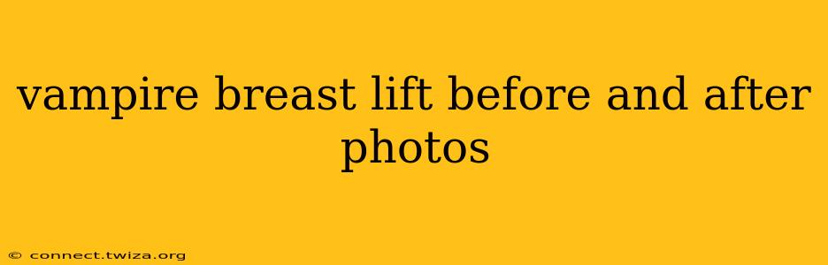 vampire breast lift before and after photos