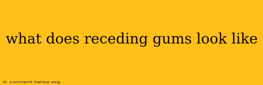 what does receding gums look like