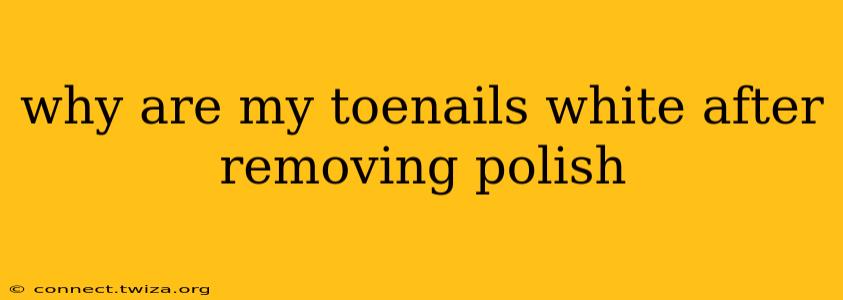 why are my toenails white after removing polish